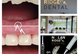 ​Ласкаво просимо до Nolan Ridge Dental