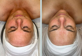 Послуги масажиста/косметолога