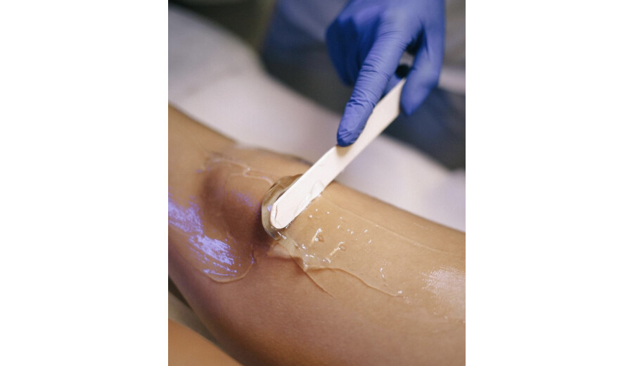 Laser hair removal -