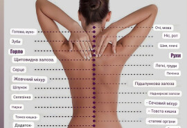 Послуги костоправа