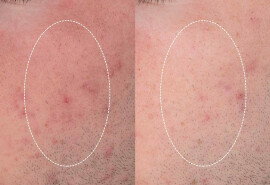 Послуги косметолога