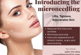 Послуги з мікронідлінгу
