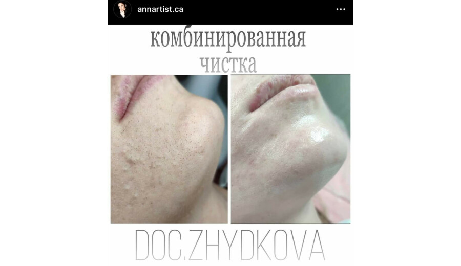 Послуги косметолога -