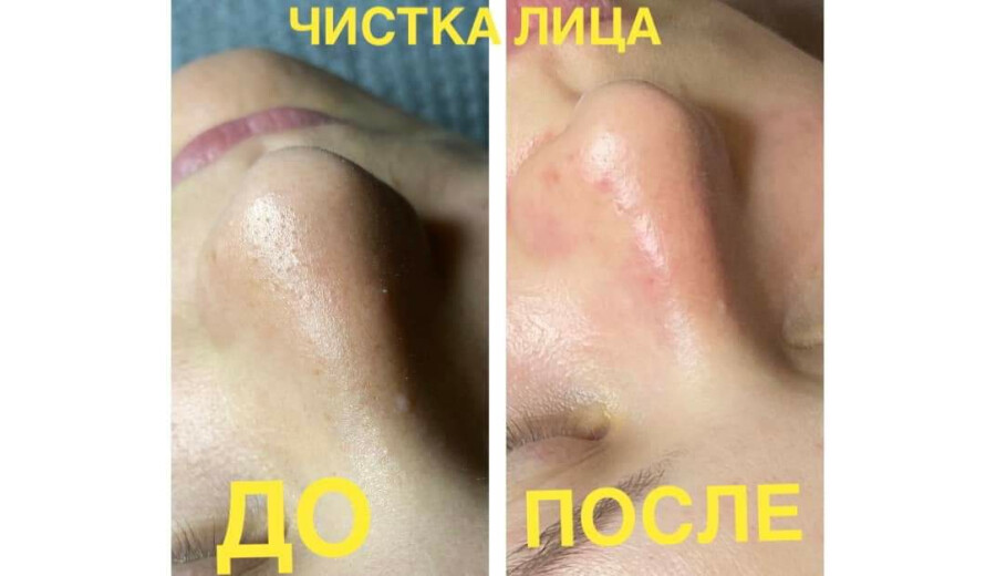 Послуги косметолога -